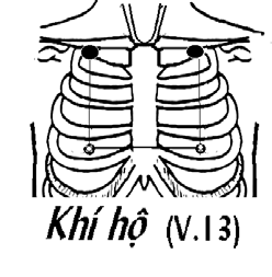 Huyệt Khí Hộ