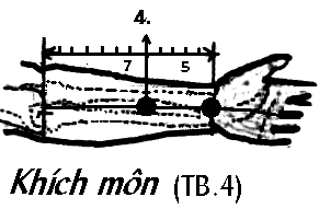 Huyệt Khích Môn