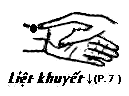 Huyệt Liệt Khuyết
