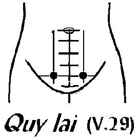 Huyệt Quy Lai