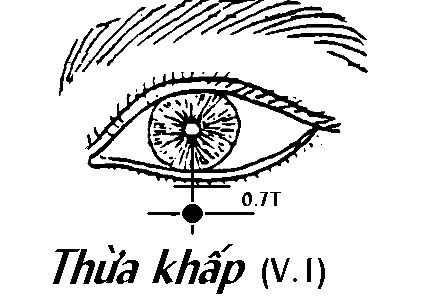 Huyệt Thừa Khấp