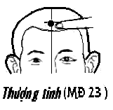 Huyệt Thượng Tinh