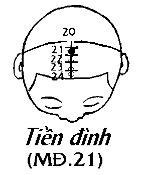 Huyệt Tiền Đính