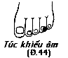 Huyệt Túc Khiếu Âm