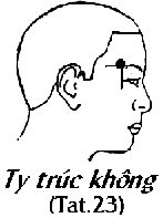 Huyệt Ty Trúc Không